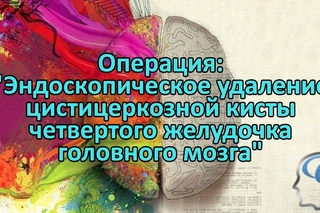 Операция. Эндоскопическое удаление цистицеркозной кисты 4-го желудочка головного мозга