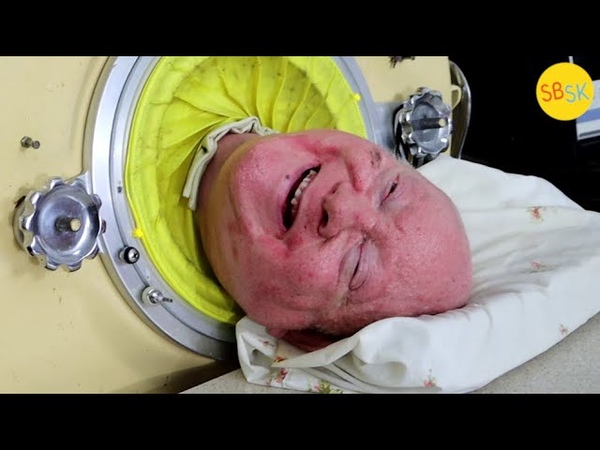 The Man in an Iron Lung ( A Polio Survivors