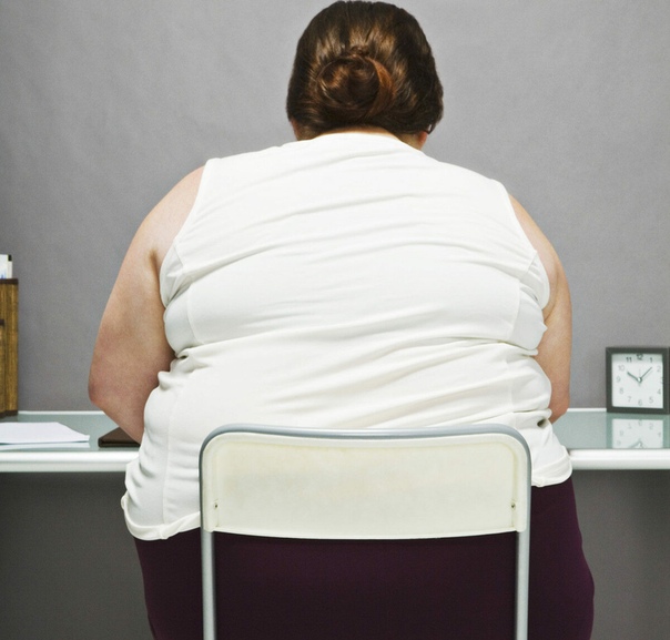 избыточный вес. ожирение третьей степени (морбидное). ожирение и позвоночник. боль в спине. ожирение спины.