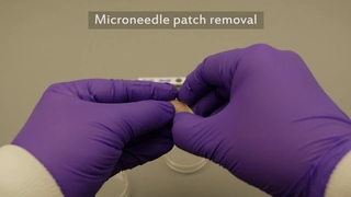 A microneedle patch that records vaccination history on skin