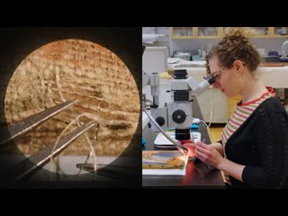 Microscopically reweaving a 1907 painting | CONSERVATION STORIES